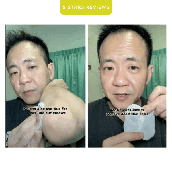 Exfoliating skincare routine for elbows and skin removal process.