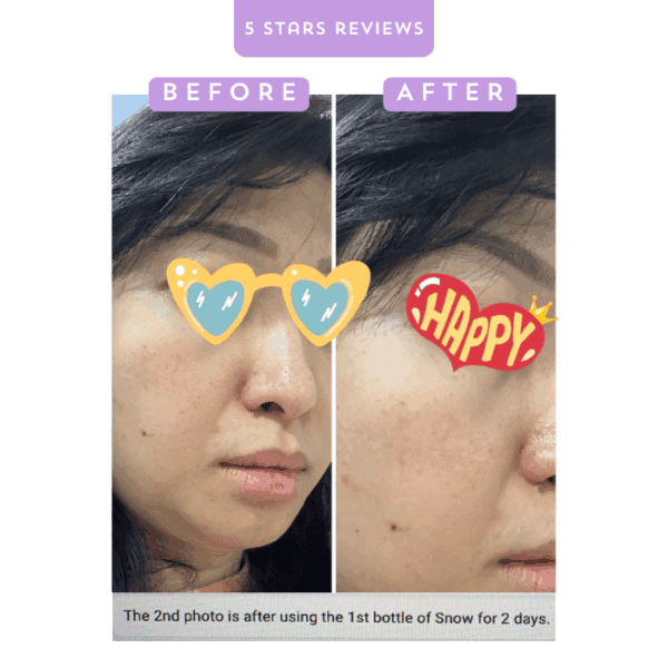Clear skin transformation after using Snow skincare for 2 days, showcasing improved complexion.