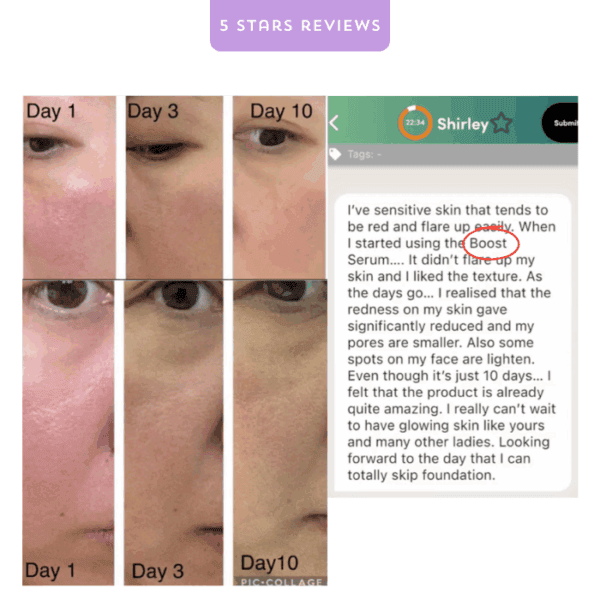 Boost serum for skin redness and pore reduction, before and after photos, positive review.