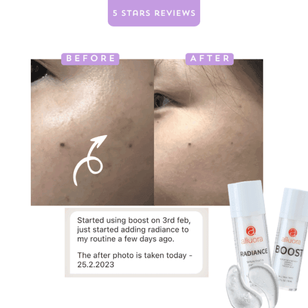 Boost skin radiance with Alluora skincare serum and boost moisturizer for youthful glow.