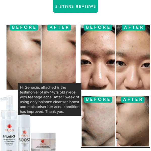 Balance skincare for acne-prone skin, alluora balance cleanser and moisturizer for clearer skin.