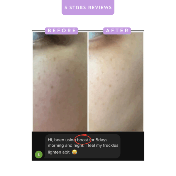 Clear skin improvement with Alluora skincare product before and after; reduce freckles and dark spots.