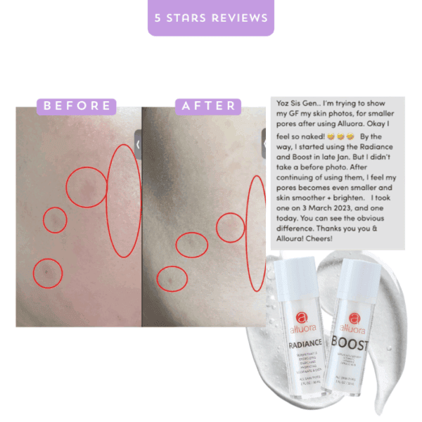 Small skin pores before and after using Alluora skincare products, visible improvement photos.