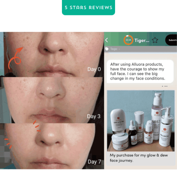 Clear skin improvement with Alluora skincare products over 7 days, glowing face transformation, skincare journey success.