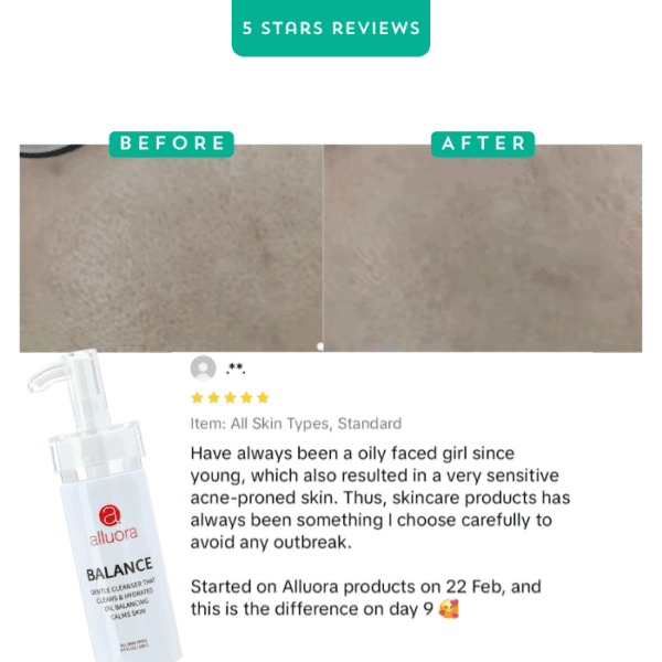 Clear skin before and after using Alluora skincare product, acne-prone skin transformation.