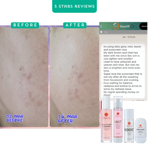 Clear skin with Alluora skincare products, visible transformation from March 2 to March 16.