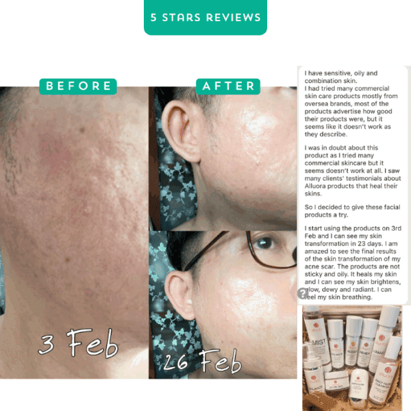 Alluora skincare before and after images showing acne scar improvement.