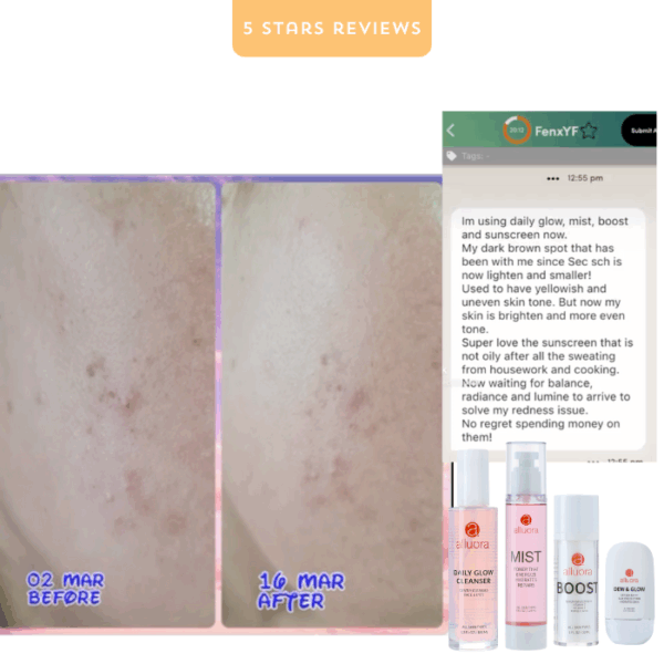 Clear skin with Alluora skincare products for uneven skin tone and dark spots.