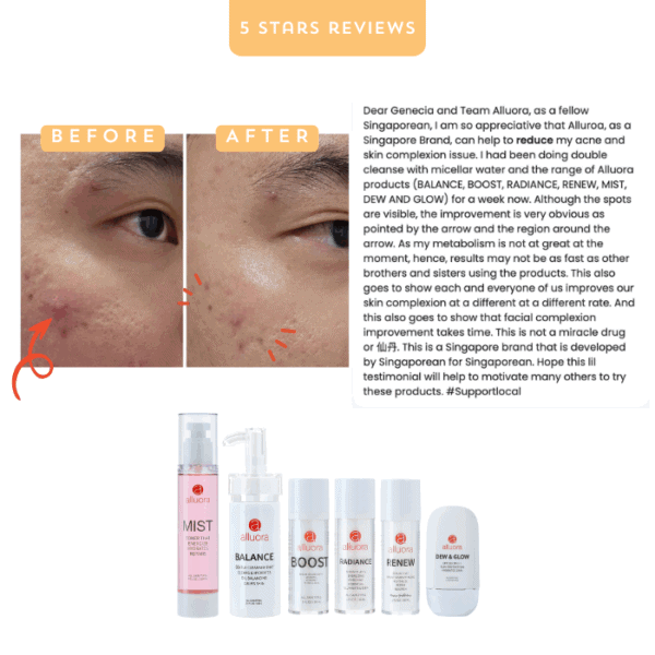 Balancing skincare products for acne recovery and skin improvement.