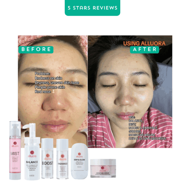 Redness and uneven skin tone improved with Alluora skincare products.
