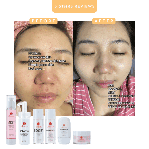 Healthy glowing skin with Alluora skincare products for redness, dryness, and uneven skin tone improvement.
