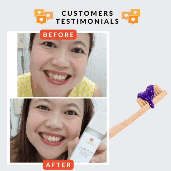 Brighter smile and teeth whitening results with Alluora teeth whitening products, before and after photos showing improved dental appearance.